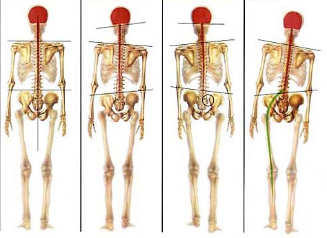 posture-golf-chiropracteur