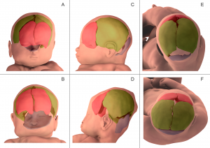 crane bébé chiropracteur